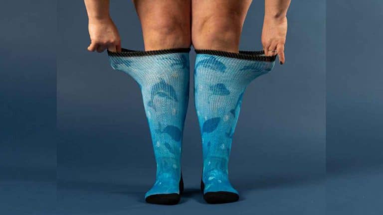 Diabetes and Your Feet